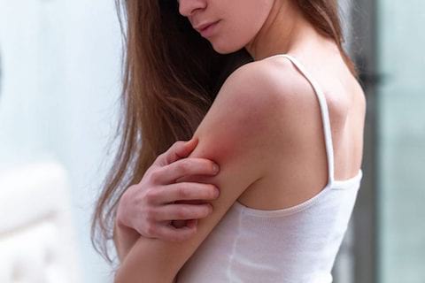 woman itching with psoriasis
